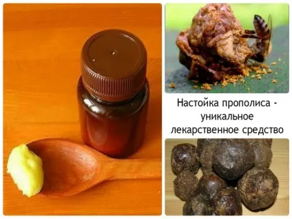 Пародонтоз лікування в домашніх умовах народними засобами (домашніх) Пародонтоз лікування в домашніх умовах народними засобами