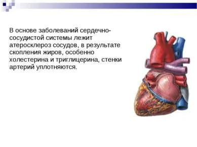 Презентація - серцево-судинні захворювання - завантажити безкоштовно