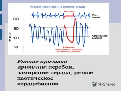 Презентація на тему захворювання серцево-судинної системи (серцево-судинної) Презентація на тему захворювання серцево-судинної системи