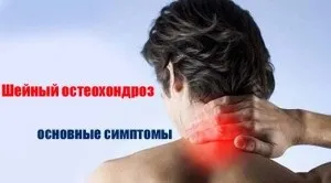 Шийний остеохондроз