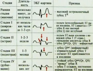 Стадії інфаркту міокарда і особливості кожної з них (стадії інфаркту міокарда) Стадії інфаркту міокарда і особливості кожної з них