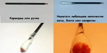Спрей і мазь люголь для горла як застосовується і чи є протипоказання (є) Спрей і мазь люголь для горла як застосовується і чи є протипоказання