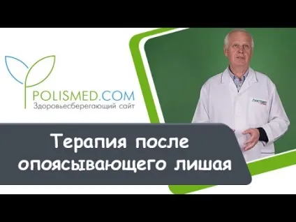 Поперековий лишай симптоми і лікування (поперековий) Поперековий лишай симптоми і лікування