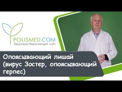 Поперековий лишай симптоми і лікування (протягом декількох місяців) Поперековий лишай симптоми і лікування