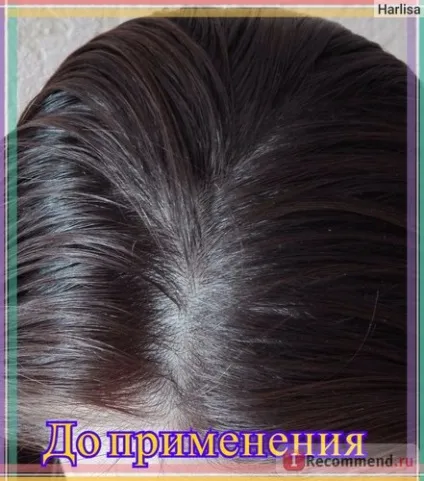 Сухий шампунь avon «advance techniques» - «звідки сніг на волоссі і що мені з цим робити! (Фото (шампунь) Сухий шампунь avon «advance techniques» - «звідки сніг на волоссі і що мені з цим робити! (фото