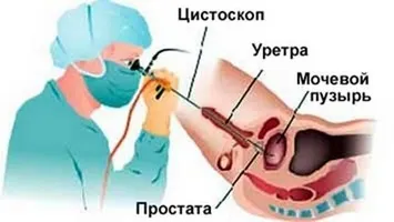 Тільки що з'явилося ефективне лікування для хронічного простатиту (ефективне) Тільки що з'явилося ефективне лікування для хронічного простатиту