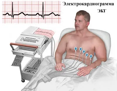 Прискорене серцебиття