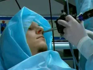 Кіста лобової пазухи причини, симптоми і лікування захворювання (операція) Кіста лобової пазухи причини, симптоми і лікування захворювання