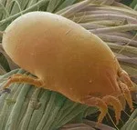 Клініка Тисленко - кліщ птероніссімус (dermatophagoides pteronyssinus)