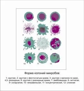 Колонії бактерій ознаки і способи визначення за допомогою приладів (колонії) Колонії бактерій ознаки і способи визначення за допомогою приладів