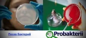 Колонії бактерій ознаки і способи визначення за допомогою приладів (ознаки) Колонії бактерій ознаки і способи визначення за допомогою приладів