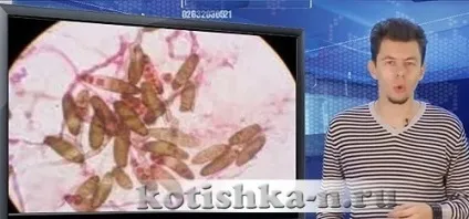 Котячий лишай у людини, як можна заразитися від хворої тварини (людини) Котячий лишай у людини, як можна заразитися від хворої тварини