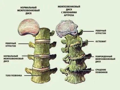 Кт як метод візуалізації шийного відділу хребетного стовпа (відділу) Кт як метод візуалізації шийного відділу хребетного стовпа