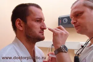 Олексій Самсонов зробив пластичну операцію, будинок 2 новини (операцію) Олексій Самсонов зробив пластичну операцію, будинок 2 новини