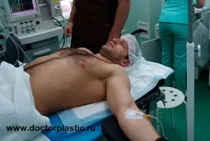 Олексій Самсонов зробив пластичну операцію, будинок 2 новини (алексей) Олексій Самсонов зробив пластичну операцію, будинок 2 новини