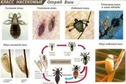 Лікування гепатиту вошами принцип дії методу (вошами) Лікування гепатиту вошами принцип дії методу