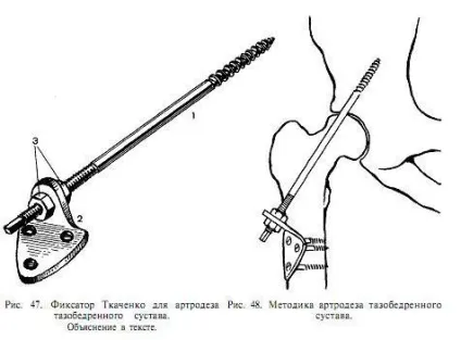 великий крутив