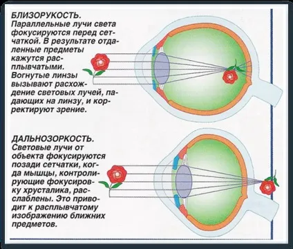 Чим відрізняються короткозорість від далекозорості