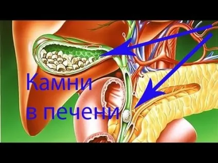 Чистка печінки магнезією в домашніх умовах як правильно застосовувати (чистка) Чистка печінки магнезією в домашніх умовах як правильно застосовувати