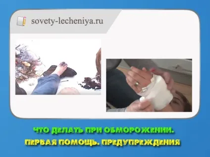 Що робити при обмороженні