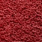 Що потрібно знати про хронічної ревматичної хвороби серця