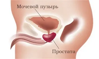 Що таке лод терапія, наскільки вона ефективна при простатиті (терапія) Що таке лод терапія, наскільки вона ефективна при простатиті