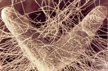 Що таке микориза в біології (біології) Що таке микориза в біології