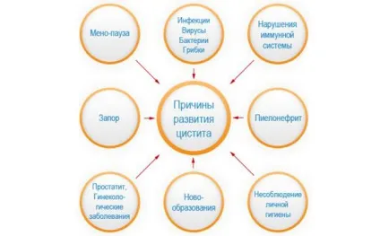 Цистит часте і хворобливе сечовипускання (хворобливе) Цистит часте і хворобливе сечовипускання