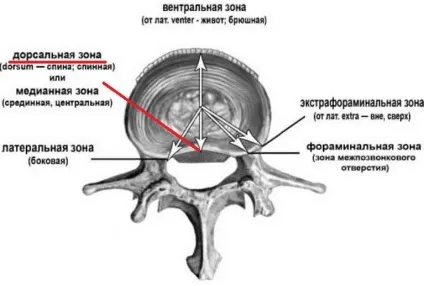 Дорзальная грижа диска що це таке, симптоми, лікування (дорзальная) Дорзальная грижа диска що це таке, симптоми, лікування