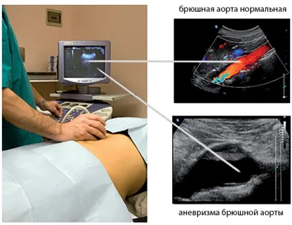 доплерографія це