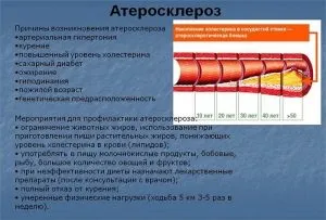 Фітотерапія при лікуванні атеросклерозу судин (фітотерапія) Фітотерапія при лікуванні атеросклерозу судин