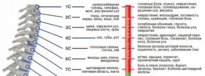 Грижа хребта шийного відділу симптоми і наслідки - my life