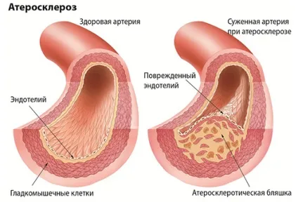 Горять стопи ніг причини можуть ховатися в патології внутрішніх органів