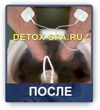 Іонна детоксикація організму, іон детокс спа (іонна очищення організму) Іонна детоксикація організму, іон детокс спа