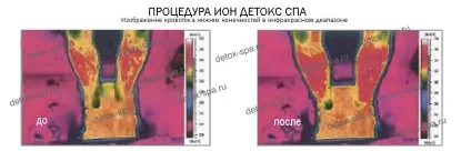 Іонна детоксикація організму, іон детокс спа (іонна очищення організму) Іонна детоксикація організму, іон детокс спа