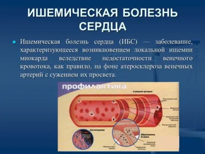 Інвалідність при ІХС (ішемічної хвороби серця) - гіпертонії, стенокардії напруги ФК2 і 3, (гіпертонії) Інвалідність при ІХС (ішемічної хвороби серця) - гіпертонії, стенокардії напруги ФК2 і 3,