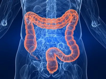 Colitis végbél - tünetek és kezelés, hogyan kell kezelni a gyertyák