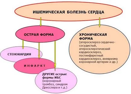 Коронарно сърдечно-болестни причини, симптоми, лечение