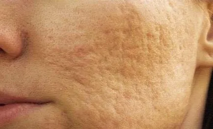 A bőr az arcán lett csomós okok és a kezelés