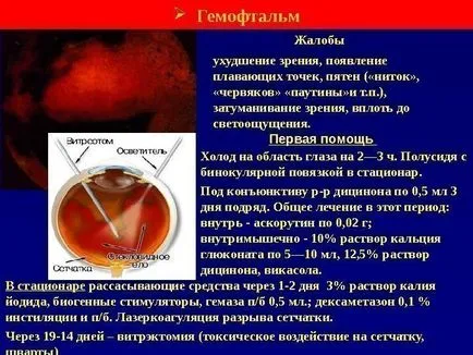 Кръвоизлив в стъкловидното тяло на очите - причини, симптоми и лечение