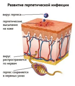 херпес лечение на главата