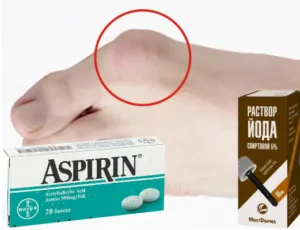 Seed kezelés a lábak és jóddal aszpirin, jód és az aszpirin a dudorok a lábak