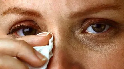 Tratamentul episclerită ochii cu remedii populare