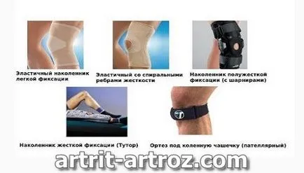 Kneepads arthrosis - hogyan válasszuk ki, és hogy a hatás