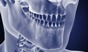 Osteomyelitis tünetei és kezelése a mandibula