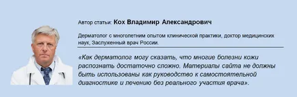 Защо сърбеж по кожата на краката причините за