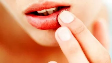 De ce se dezvolta buzele bolii și cum să le recunoască