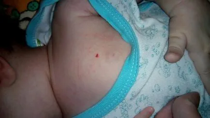 De ce corpul apare birthmark roșu