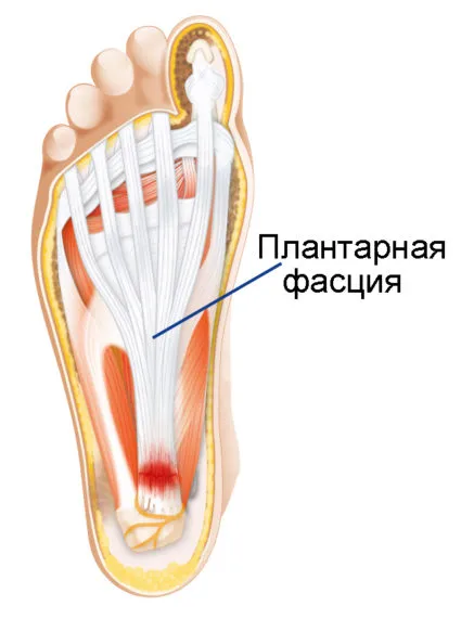 Плантарна Апоневрозното причини и лечение