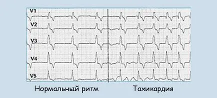 След хранене, ускорява сърдечния ритъм причини